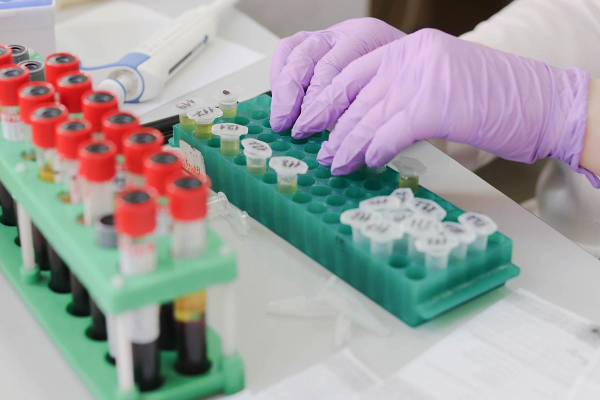 Koronavírus – Negatív teszttel rövidíthető lesz az angliai karantén