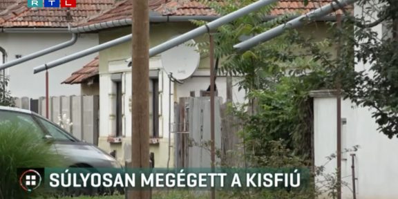 megégett kisfiú Újkígyóson