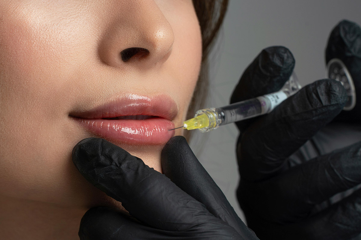 Engedély nélkül töltött ajkakat Békéscsabán egy kozmetikus – pénzbüntetés lett a vége